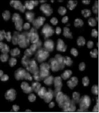 Image:Drosophila nuclei.JPG