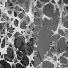 bone under microscope - 3D