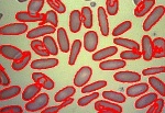 Red blood cells, captured