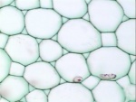 Parenchyma (plant cells)